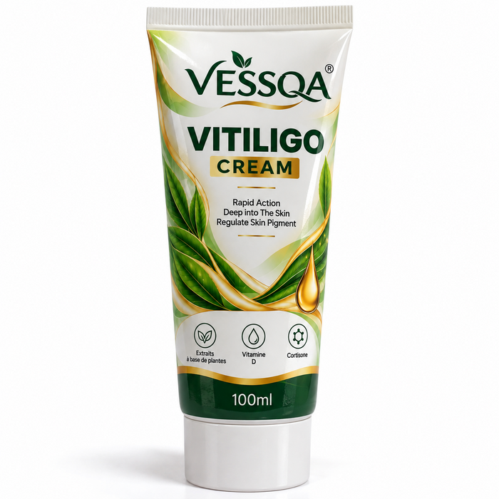 VESSQA Vitiligo Cream – كريم العناية بالبشرة المتصبغة 100ml